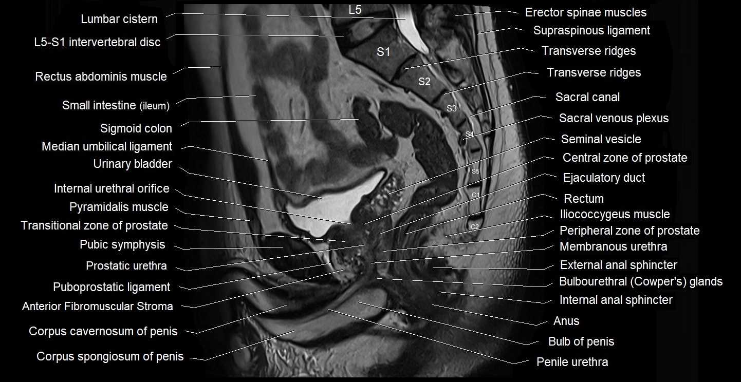 male pelvis sagittal cross sectional anatomy 3T mri image 23.webp